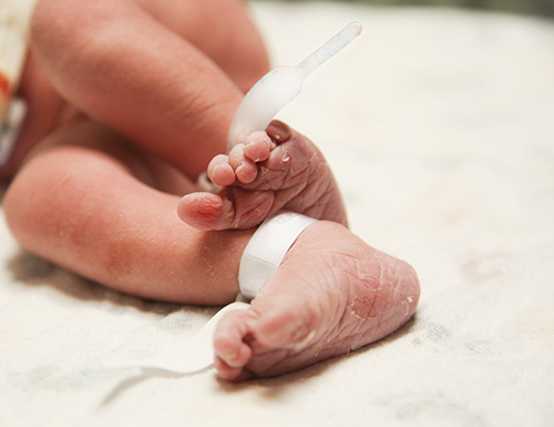  Campanha chama atenção para nascimentos prematuros no País